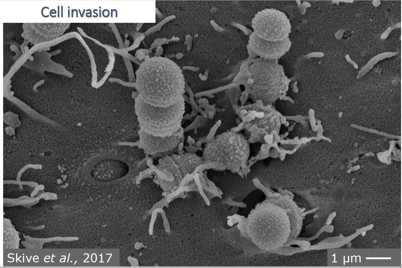 Streptokokken-Zellinvasion unter dem Mikroskop